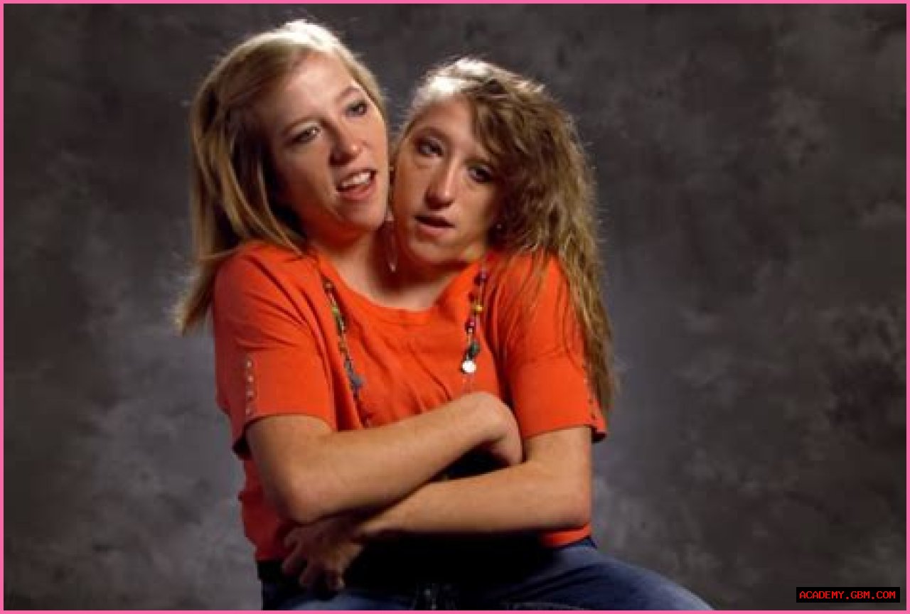 Understanding The Abby And Brittany Hensel Family Tragedy